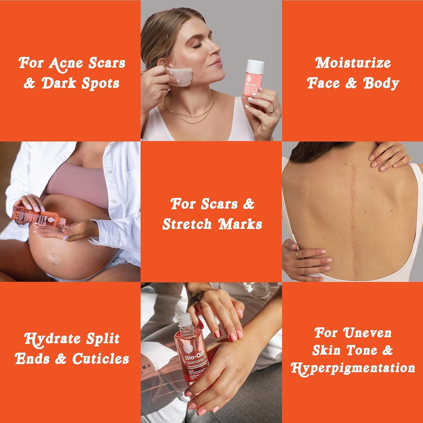 Bio-Oil Skincare Body Oil, Vitamin E Serum for Scars & Stretchmarks, Dermatologist Recommended, All Skin Types, 6.7 Oz
