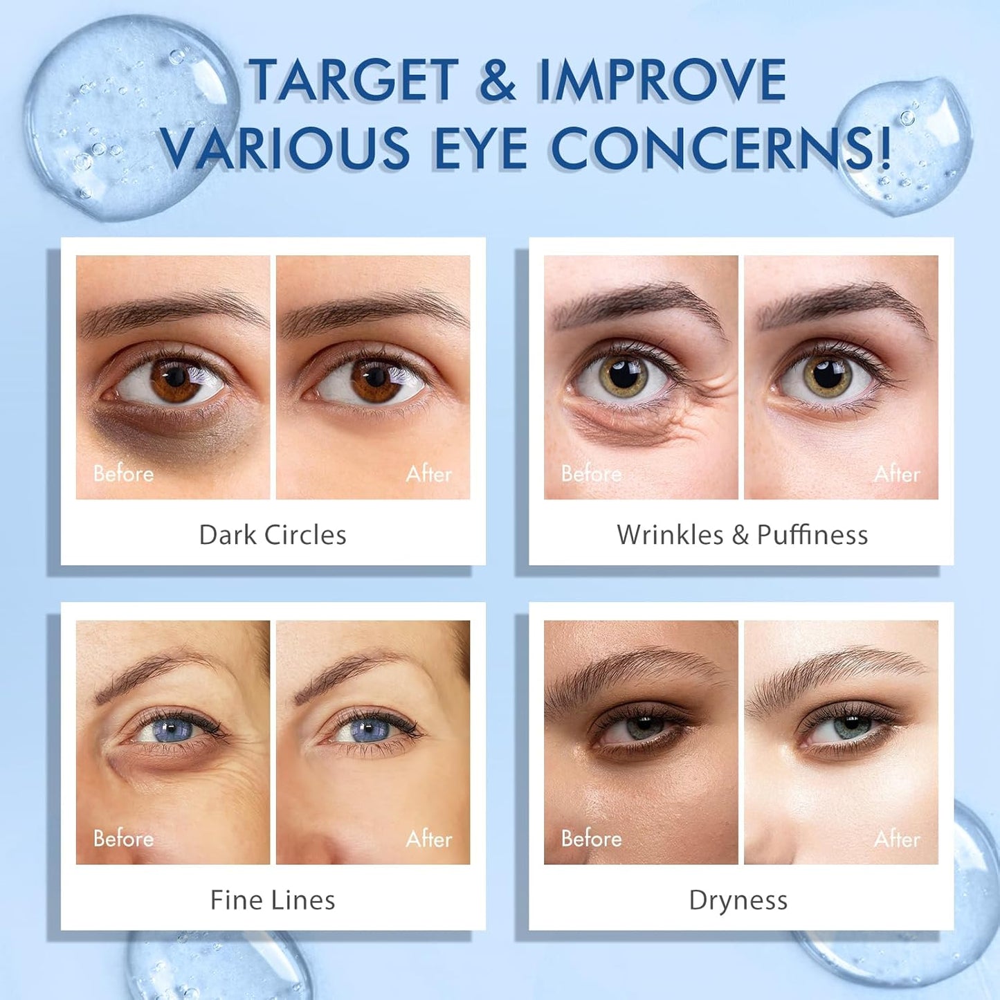 5% Caffeine Eye Serum anti Aging,Under Eye Roller Serum Reduce Dark Circles, Puffiness, Fine Lines, Wrinkles 360° Massage Ball Eye Treatment Serum Eye Balm for Late Nights, Overtime