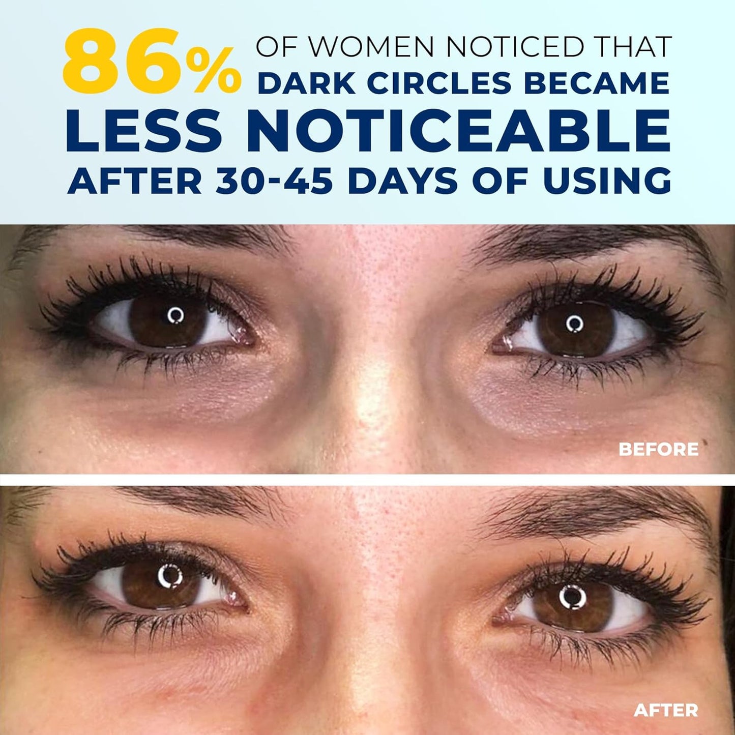 Under Eye Brightener for Dark Circles – 4 in 1 with Niacinamide, 5% Caffeine, Retinol & Peptides - Eye Cream anti Aging for Reduce Wrinkles, Puffiness and Bags under Eyes