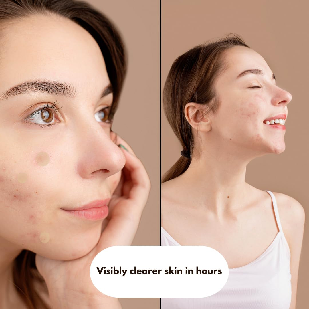 Shuvi Hydrocolloid Acne Blemish Patch - Zits and Blemishes Treatment, All Night or Day Adhesion, Vegan-Friendly, Cruelty-Free - 36 Count