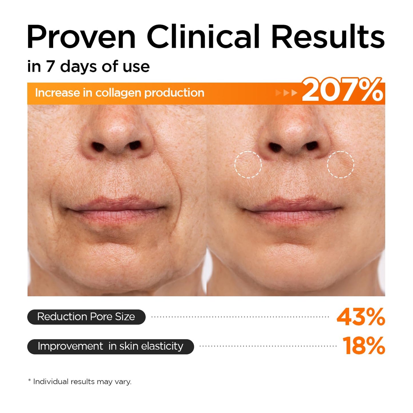 P.CALM Retinolagen Ampoule 30Ml | Pore Tightening Korean Glass Skin Serum for Retinol Bigginer with Micro Dosing Retinal, Vegan Hydrolyzed Collagen, Bakuchiol, PHA | Vegan Korean Skincare