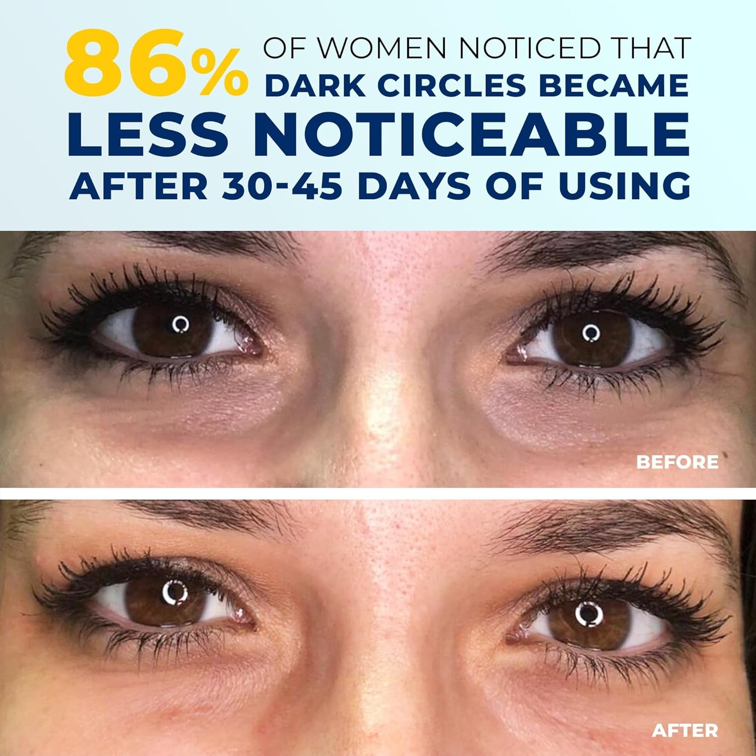Under Eye Brightener for Dark Circles – 4 in 1 with Niacinamide, 5% Caffeine, Retinol & Peptides - Eye Cream anti Aging for Reduce Wrinkles, Puffiness and Bags under Eyes