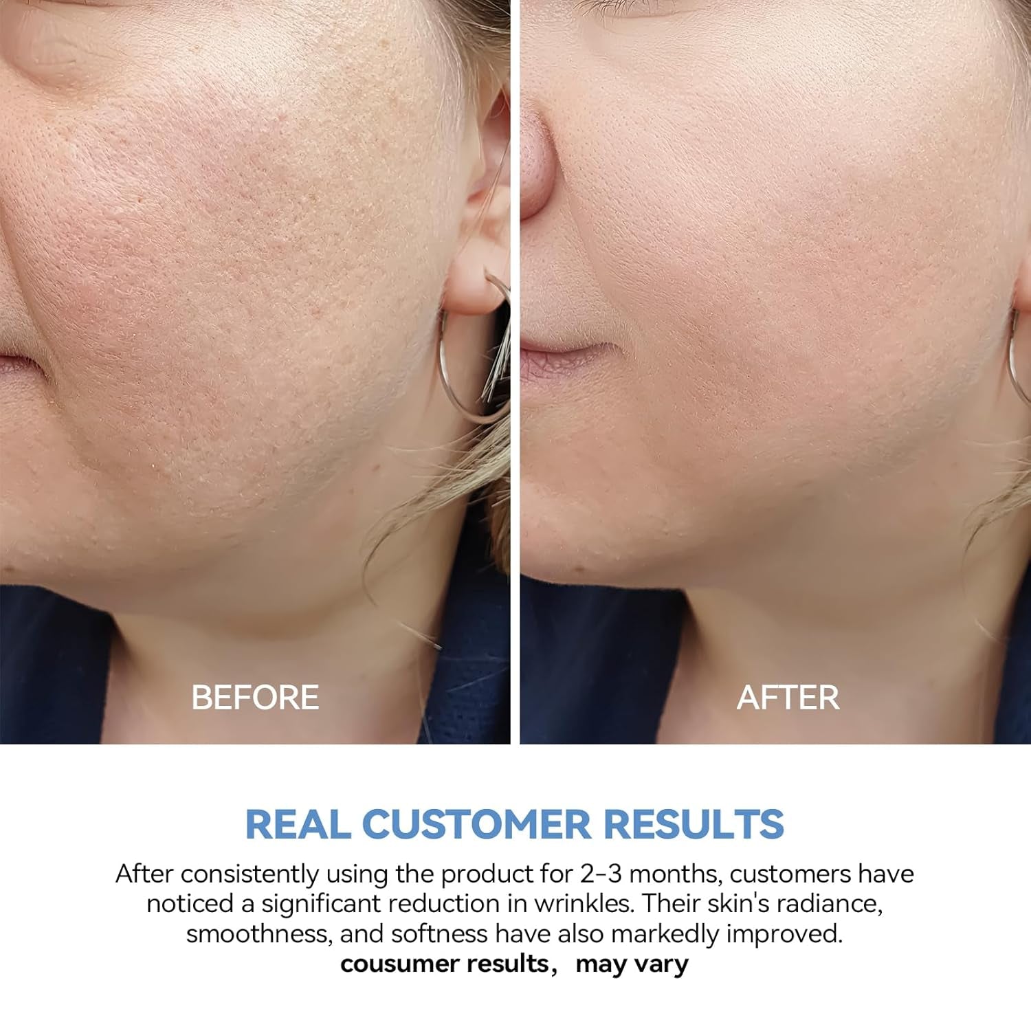 Ultra-Hydrating Serum 3% Hyaluronic Acid Skin Repair|Pre-Makeup Skincare|Anti-Aging Serum for Face Single-Use Vials Skincare|Hyaluronic Acid Tubes for Sensitive Skin|4D Hyaluronic Acid(1.2 Ml)*30
