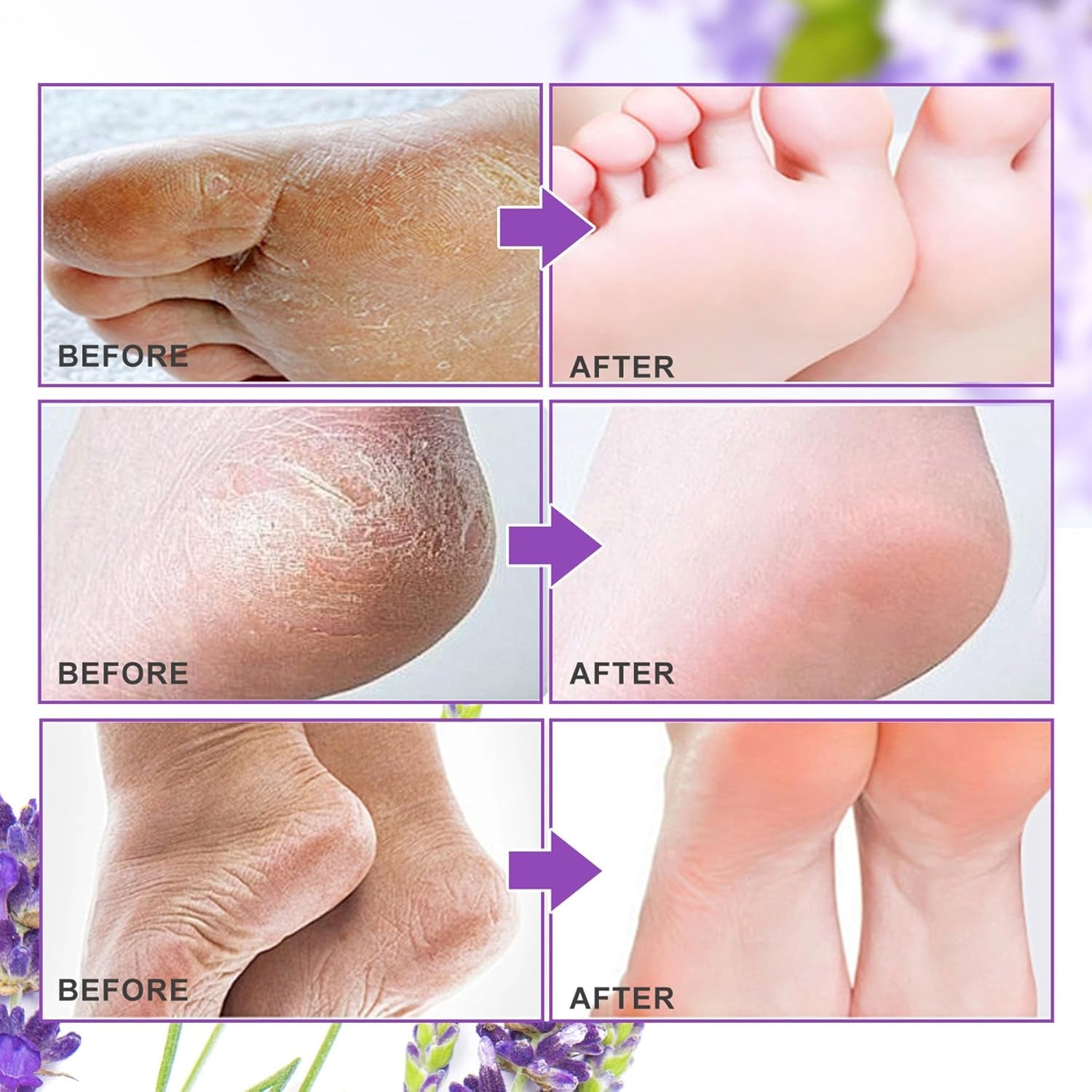 ALIVER Foot Peel Mask 3 Pack, Exfoliator Peel off Calluses Dead Skin Callus Remover, Baby Soft Smooth Touch Feet-Men Women (Lavender)