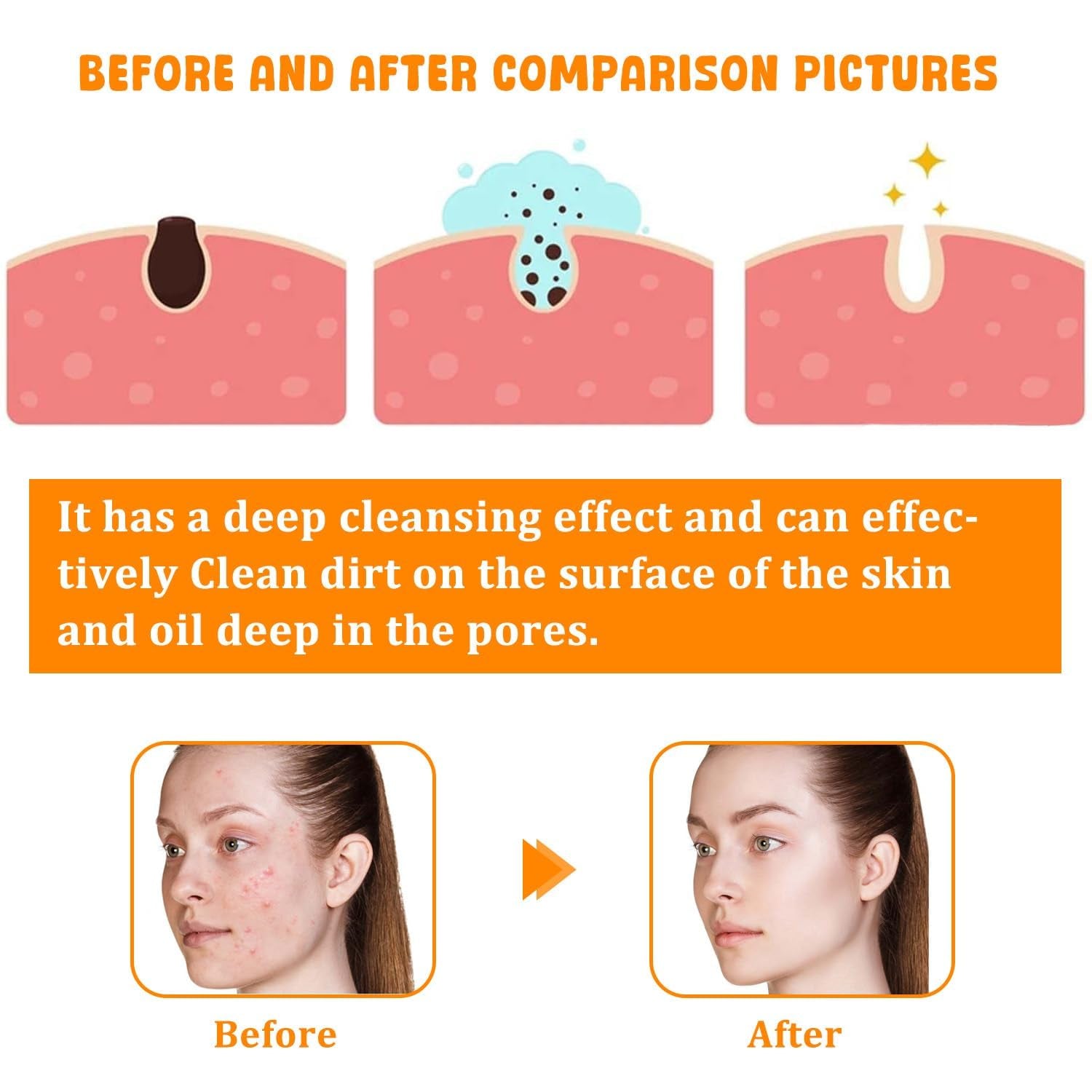 Turmeric Facial Cleanser, Turmeric Facial Wash, Turmeric Foaming Cleanser for All Skin
