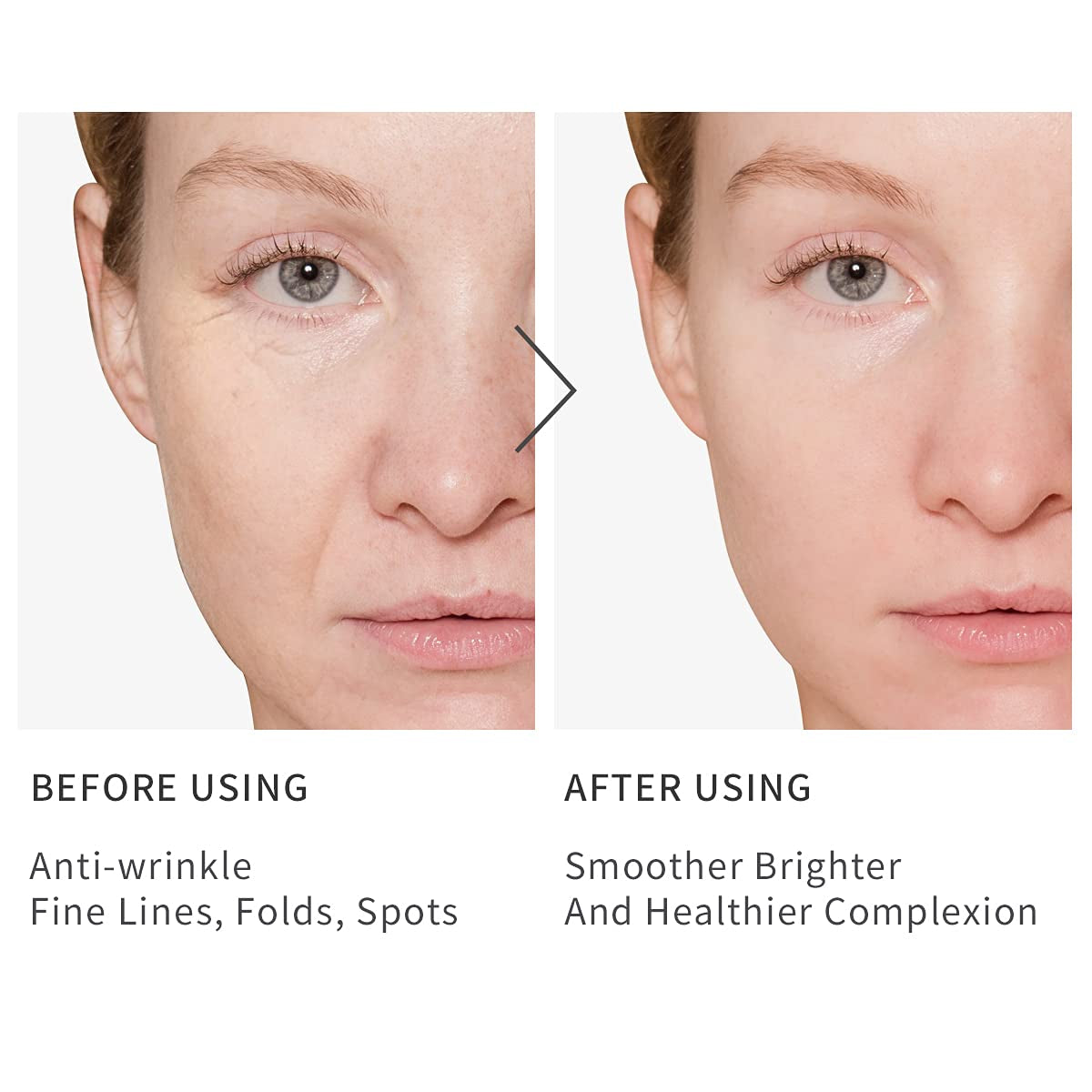 HKH Vitamin C Super Serum for Face, anti Aging Serum with Hyaluronic Acid Supplements, Vitamin E, Reduces Wrinkles, Dark Spot Remover for Face, Retinol Serum for Face, Face Serum for Women