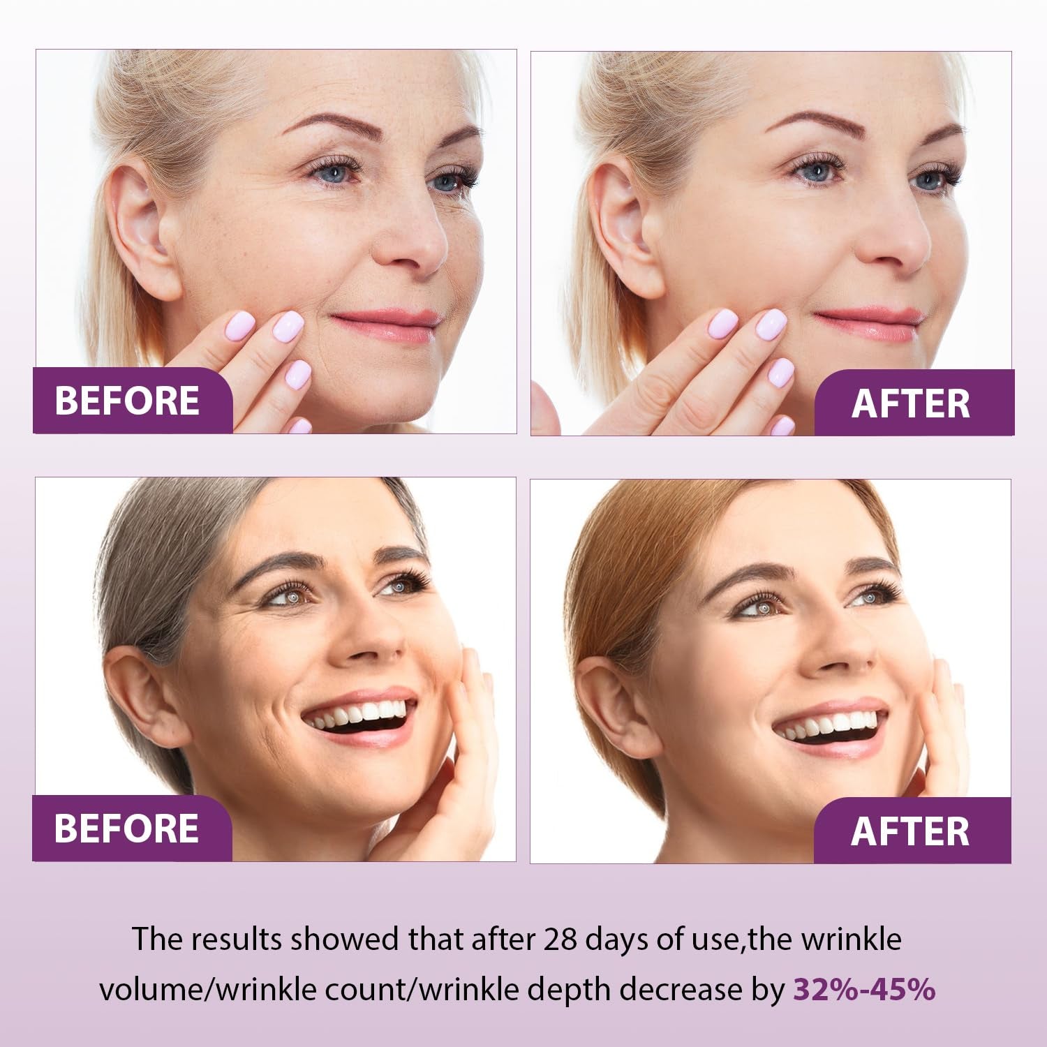 Venature Bakuchiol Retinol Rejuvenation Serum,2024 Best Retinol Serum for Wrinkles Bakuchiol Retinol Face Serum Korean, Retinol Serum for Wrinkles, Reduce Wrinkles(2Pcs)