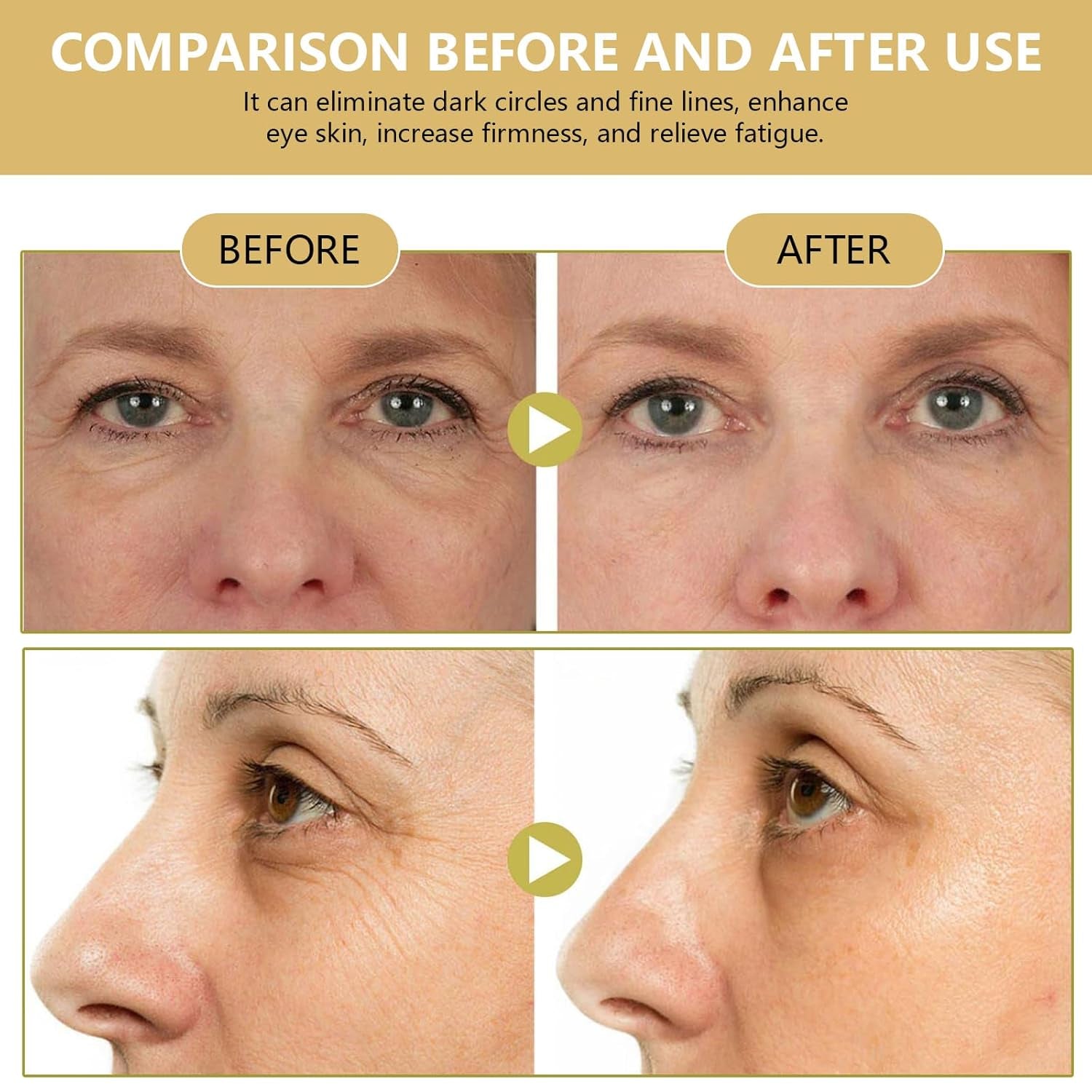 COSMOO Snail Peptide Advanced under Eye Cream for Dark Circles, with Snail Mucin, Advanced Snail Eye Stick for Puffiness & Bags, Reduce Wrinkles, Fine Lines, Moisturizating Skin