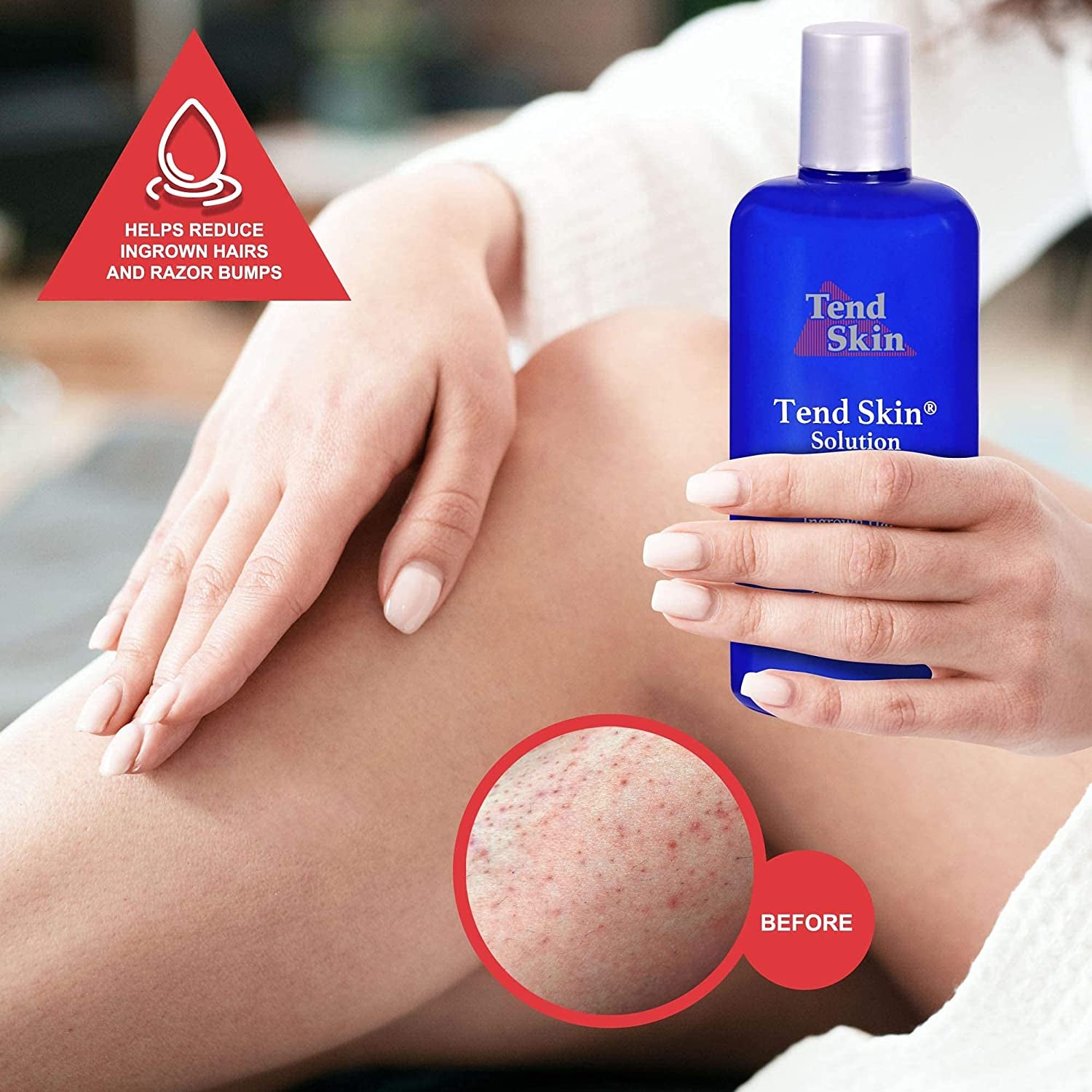 Tend Skin the Skin Care Solution for Unsightly Razor Bumps, Ingrown Hair and Razor Burns, 8 Fl Oz Bottle