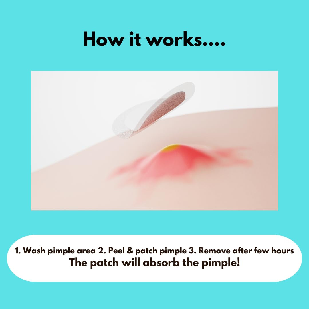 Shuvi Hydrocolloid Acne Blemish Patch - Zits and Blemishes Treatment, All Night or Day Adhesion, Vegan-Friendly, Cruelty-Free - 36 Count